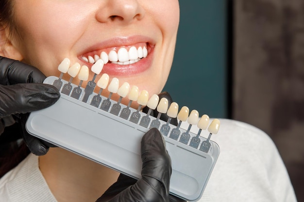 can porcelain veneers fix chipped or stained teeth
