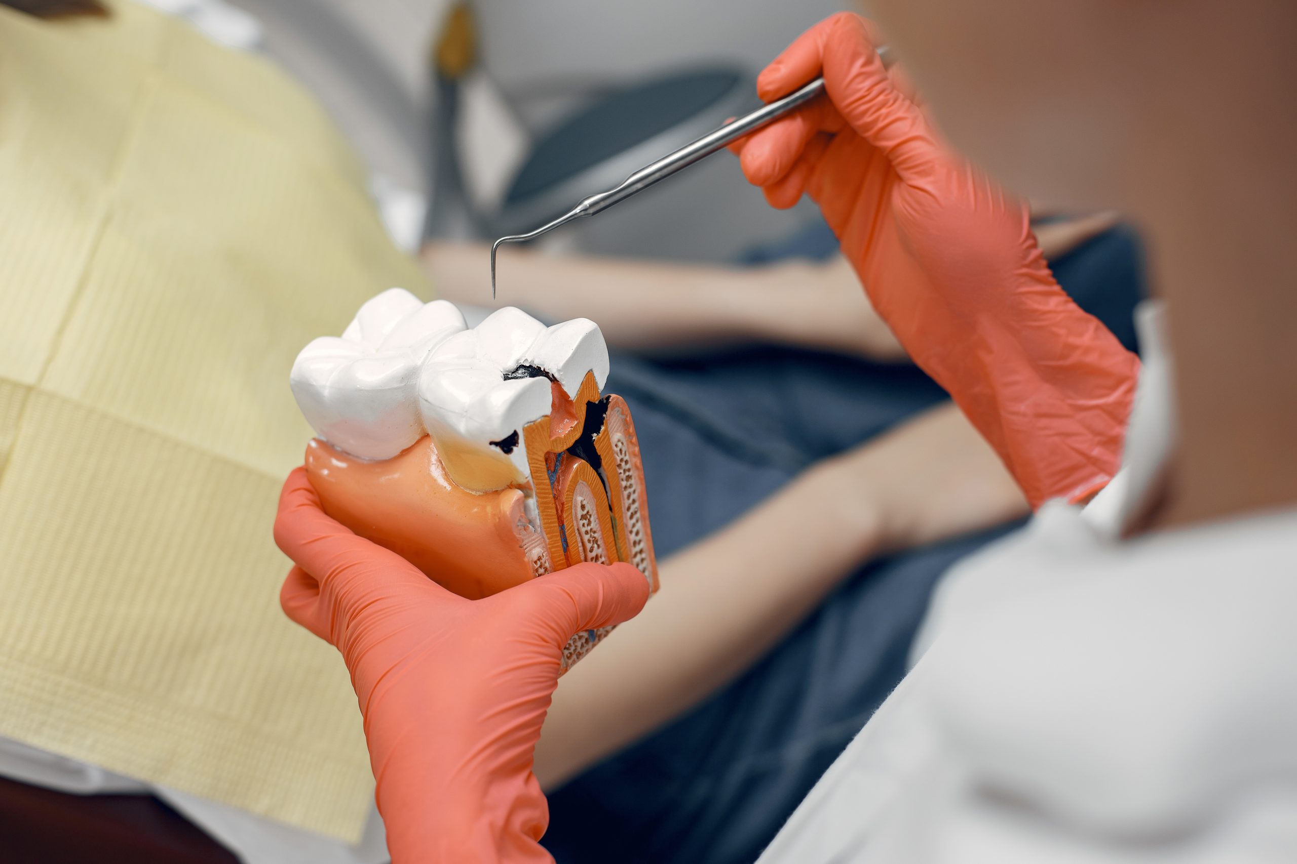 When Is Root Canal Therapy Necessary, and What Are the Warning Signs